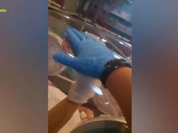 Γιατρός κρατάει το χέρι και δίνει κουράγιο σε ασθενή στην ειδική κάψουλα αεροδιακομιδής