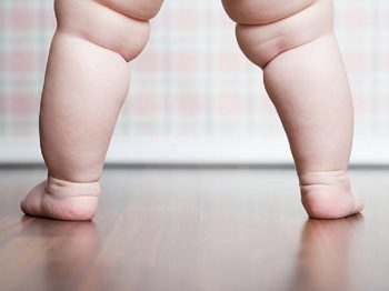 Είναι πράγματι τα πόδια του παιδιού μου στραβά;