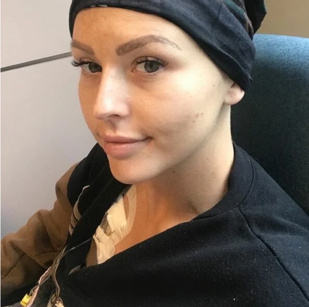 Αρνήθηκαν να της κάνουν μαστογραφία γιατί ήταν «πολύ νέα», 8 μήνες αργότερα διαγνώστηκε με καρκίνο 4ου σταδίου