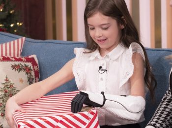 Συγκινεί 7χρονη που ανοίγει για πρώτη φορά τα δώρα της με το τεχνητό της χέρι